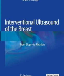 Interventional Ultrasound of the Breast: From Biopsy to Ablation eBook
