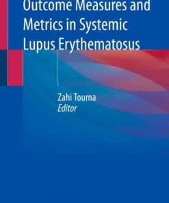 Outcome Measures and Metrics in Systemic Lupus Erythematosus eBook