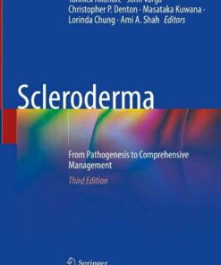 Scleroderma: From Pathogenesis to Comprehensive Management, 3rd Edition eBook