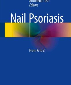 Nail Psoriasis: From A to Z eBook