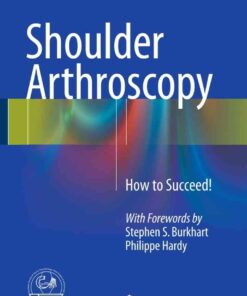 Shoulder Arthroscopy: How to Succeed! eBook