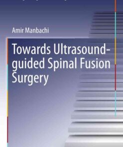 Towards Ultrasound-guided Spinal Fusion Surgery eBook