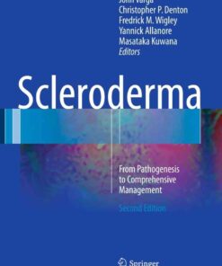 Scleroderma: From Pathogenesis to Comprehensive Management, 2nd Edition eBook
