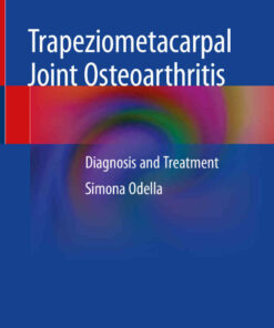 Trapeziometacarpal Joint Osteoarthritis: Diagnosis and Treatment eBook