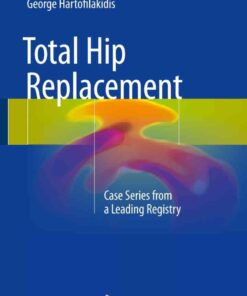 Total Hip Replacement: Case Series from a Leading Registry eBook