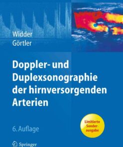 Doppler- und Duplexsonographie der hirnversorgenden Arterien eBook