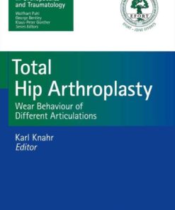 Total Hip Arthroplasty: Wear Behaviour of Different Articulations, 1st Edition eBook
