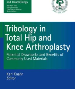 Tribology in Total Hip and Knee Arthroplasty: Potential Drawbacks and Benefits of Commonly Used Materials eBook