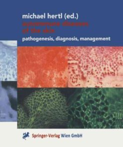 Autoimmune Diseases of the Skin: Pathogenesis, Diagnosis, Management, 1st Edition eBook