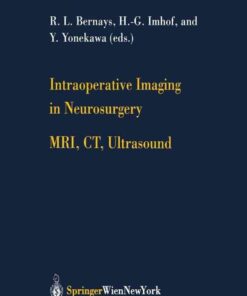 Intraoperative Imaging in Neurosurgery: MRI, CT, Ultrasound eBook