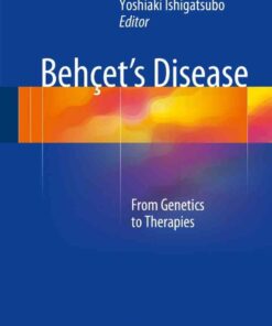 Behçet's Disease: From Genetics to Therapies eBook